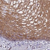 Anti-S100A11 antibody produced in rabbit Prestige Antibodies® Powered by Atlas Antibodies, affinity isolated antibody, buffered aqueous glycerol solution