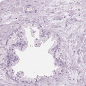 Anti-CFAP126 antibody produced in rabbit Prestige Antibodies® Powered by Atlas Antibodies, affinity isolated antibody, buffered aqueous glycerol solution