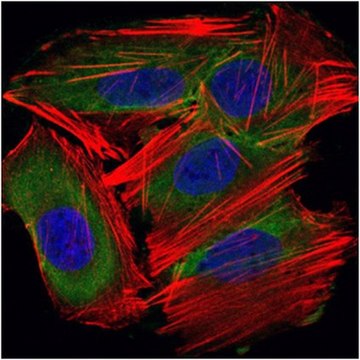 Anti-UBE2I Antibody, clone 1B10 ascites fluid, clone 1B10, from mouse