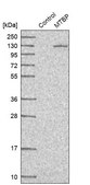 Anti-MTBP antibody produced in rabbit Prestige Antibodies® Powered by Atlas Antibodies, affinity isolated antibody, buffered aqueous glycerol solution