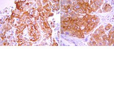 Anti-EGFR (cytoplasmic domain) Antibody, clone 8G6.2 clone 8G6.2, from mouse