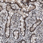 Anti-MIER1 antibody produced in rabbit Prestige Antibodies® Powered by Atlas Antibodies, affinity isolated antibody, buffered aqueous glycerol solution