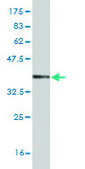 Monoclonal Anti-DYRK2 antibody produced in mouse clone 6E2, purified immunoglobulin, buffered aqueous solution