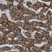 Anti-MDH2 antibody produced in rabbit Prestige Antibodies® Powered by Atlas Antibodies, affinity isolated antibody, buffered aqueous glycerol solution