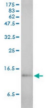 Anti-SAA1 Mouse mAb (3C11-2C1) liquid, clone 3C11-2C1, Calbiochem&#174;