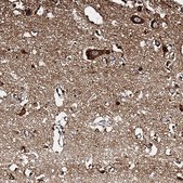 Anti-NDUFA12 antibody produced in rabbit Prestige Antibodies® Powered by Atlas Antibodies, affinity isolated antibody, buffered aqueous glycerol solution