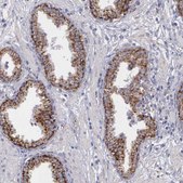 Anti-SYNJ2BP antibody produced in rabbit Prestige Antibodies® Powered by Atlas Antibodies, affinity isolated antibody, buffered aqueous glycerol solution