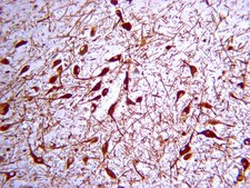 Anti-Tyrosine Hydroxylase Antibody Chemicon®, from rabbit
