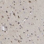 Anti-ZDHHC17 antibody produced in rabbit Prestige Antibodies® Powered by Atlas Antibodies, affinity isolated antibody, buffered aqueous glycerol solution