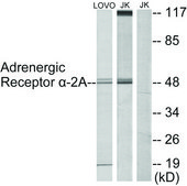 Anti-Adrenergic Receptor α-2A antibody produced in rabbit affinity isolated antibody