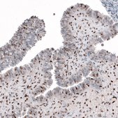 Anti-SLFN11 antibody produced in rabbit Prestige Antibodies® Powered by Atlas Antibodies, affinity isolated antibody, buffered aqueous glycerol solution