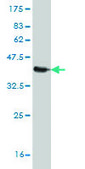 Monoclonal Anti-S100A11 antibody produced in mouse clone 2F4, purified immunoglobulin, buffered aqueous solution