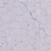Anti-CCDC40 antibody produced in rabbit Prestige Antibodies® Powered by Atlas Antibodies, affinity isolated antibody, buffered aqueous glycerol solution