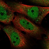 Anti-SMAD5 antibody produced in rabbit Prestige Antibodies® Powered by Atlas Antibodies, affinity isolated antibody, buffered aqueous glycerol solution
