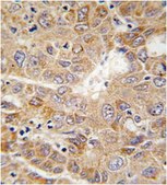 Anti-PGK1 Antibody (Center) from rabbit