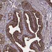 Monoclonal Anti-TUFM antibody produced in mouse Prestige Antibodies® Powered by Atlas Antibodies, clone CL2242, purified immunoglobulin, buffered aqueous glycerol solution