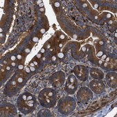 Anti-CCDC186 antibody produced in rabbit Prestige Antibodies® Powered by Atlas Antibodies, affinity isolated antibody, buffered aqueous glycerol solution