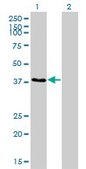 Monoclonal Anti-RNF14 antibody produced in mouse clone 4G9, purified immunoglobulin, buffered aqueous solution