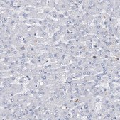 Anti-FOXC1 antibody produced in rabbit Prestige Antibodies® Powered by Atlas Antibodies, affinity isolated antibody, buffered aqueous glycerol solution