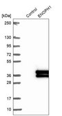 Anti-ENOPH1 antibody produced in rabbit Prestige Antibodies® Powered by Atlas Antibodies, affinity isolated antibody, buffered aqueous glycerol solution