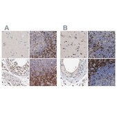 Anti-GIMAP4 antibody produced in rabbit Prestige Antibodies® Powered by Atlas Antibodies, affinity isolated antibody, buffered aqueous glycerol solution