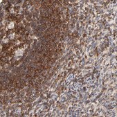 Anti-WIPF1 antibody produced in rabbit Prestige Antibodies® Powered by Atlas Antibodies, affinity isolated antibody, buffered aqueous glycerol solution