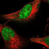Anti-PSMD13 antibody produced in rabbit Prestige Antibodies® Powered by Atlas Antibodies, affinity isolated antibody, buffered aqueous glycerol solution