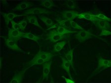 Anti-Profilin 1 (N-terminal) antibody produced in rabbit ~1 mg/mL, affinity isolated antibody, buffered aqueous solution