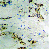 Anti-phospho-SSB (pSer366) antibody produced in rabbit affinity isolated antibody