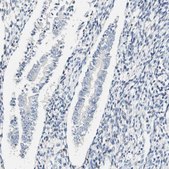 Anti-FMO3 antibody produced in rabbit Prestige Antibodies® Powered by Atlas Antibodies, affinity isolated antibody, buffered aqueous glycerol solution