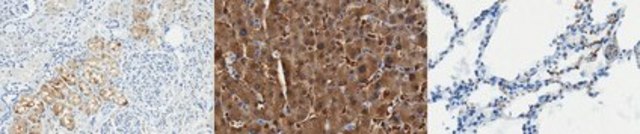 Anti-WISP-3 Antibody, clone 13C4.1 clone 13C4.1, from mouse