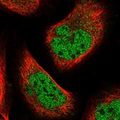 Anti-BTBD6 antibody produced in rabbit Prestige Antibodies® Powered by Atlas Antibodies, affinity isolated antibody, buffered aqueous glycerol solution