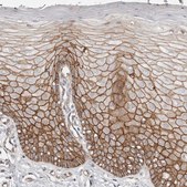 Anti-CTNNB1 antibody produced in rabbit Prestige Antibodies® Powered by Atlas Antibodies, affinity isolated antibody, buffered aqueous glycerol solution