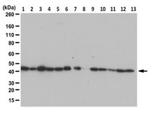 Anti-beta Actin Antibody, arginylated (N-terminal) from rabbit, purified by affinity chromatography