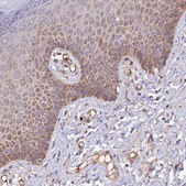 Anti-WDFY4 antibody produced in rabbit Prestige Antibodies® Powered by Atlas Antibodies, affinity isolated antibody, buffered aqueous glycerol solution