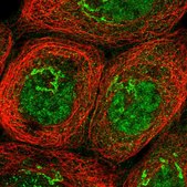Anti-HKR1 antibody produced in rabbit Prestige Antibodies® Powered by Atlas Antibodies, affinity isolated antibody, buffered aqueous glycerol solution