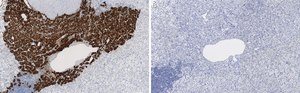 Anti-Dopamine β Hydroxylase Antibody, clone 2B11 ZooMAb® Rabbit Monoclonal recombinant, expressed in HEK 293 cells