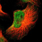 Anti-FOXN2 antibody produced in rabbit Prestige Antibodies® Powered by Atlas Antibodies, affinity isolated antibody, buffered aqueous glycerol solution