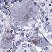 Anti-SLC6A2 Prestige Antibodies® Powered by Atlas Antibodies, affinity isolated antibody