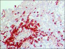 Anti-Human IgG (whole molecule)−Peroxidase antibody produced in rabbit IgG fraction of antiserum, buffered aqueous solution
