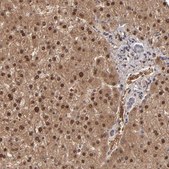 Anti-ITIH4 antibody produced in rabbit Ab1, Prestige Antibodies® Powered by Atlas Antibodies, affinity isolated antibody, buffered aqueous glycerol solution