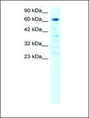 Anti-PARP3 antibody produced in rabbit affinity isolated antibody