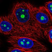 Anti-NOM1 antibody produced in rabbit Prestige Antibodies® Powered by Atlas Antibodies, affinity isolated antibody, buffered aqueous glycerol solution