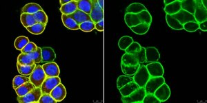 Anti-Epithelial Cell Adhesion Molecule (EpCAM) Antibody, clone 8 clone mab 8, from mouse