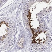 Anti-CABS1 antibody produced in rabbit Prestige Antibodies® Powered by Atlas Antibodies, affinity isolated antibody, buffered aqueous glycerol solution