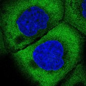 Anti-EIF3J antibody produced in rabbit Prestige Antibodies® Powered by Atlas Antibodies, affinity isolated antibody, buffered aqueous glycerol solution