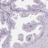 Anti-HSD17B3 antibody produced in rabbit Prestige Antibodies® Powered by Atlas Antibodies, affinity isolated antibody, buffered aqueous glycerol solution