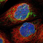 Anti-MRPS23 antibody produced in rabbit Prestige Antibodies® Powered by Atlas Antibodies, affinity isolated antibody, buffered aqueous glycerol solution