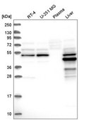 Anti-AMDHD1 antibody produced in rabbit Prestige Antibodies® Powered by Atlas Antibodies, affinity isolated antibody, buffered aqueous glycerol solution