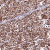 Anti-MRPS12 antibody produced in rabbit Prestige Antibodies® Powered by Atlas Antibodies, affinity isolated antibody, buffered aqueous glycerol solution